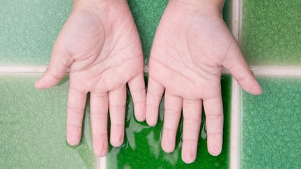 Hender med skrukkete hud etter å ha vært i vann