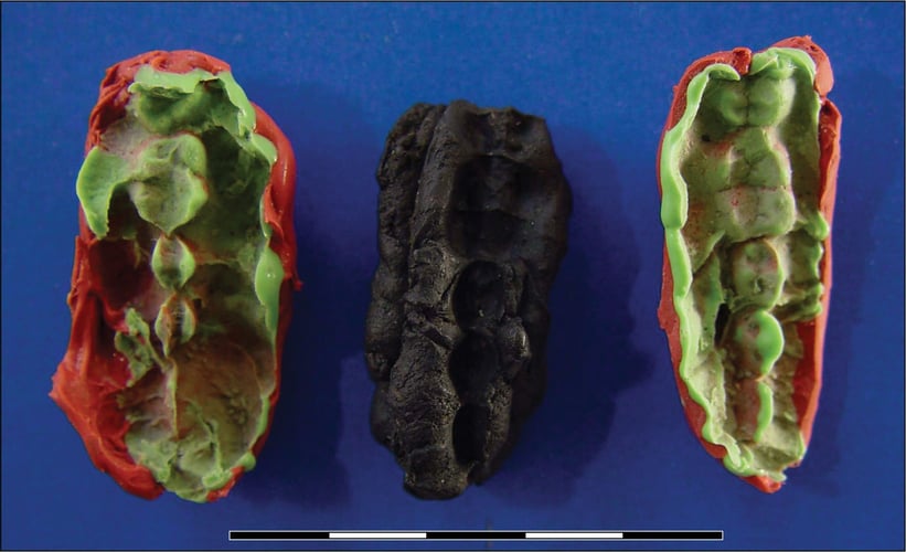 Tre klumper med tannmerker: En svart klump i midten og en rød og grønn på hver side
