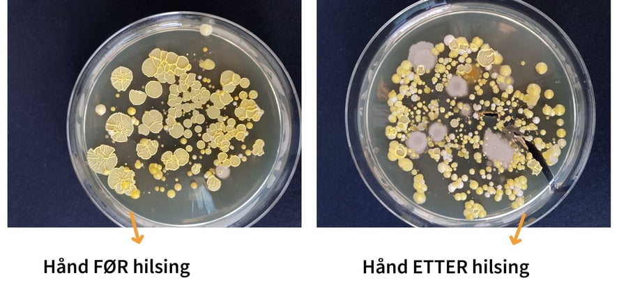 To petriskåler med bakterieprøver fra hånd før og etter hilsing