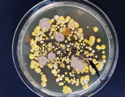 Petriskål med bakterieprøve